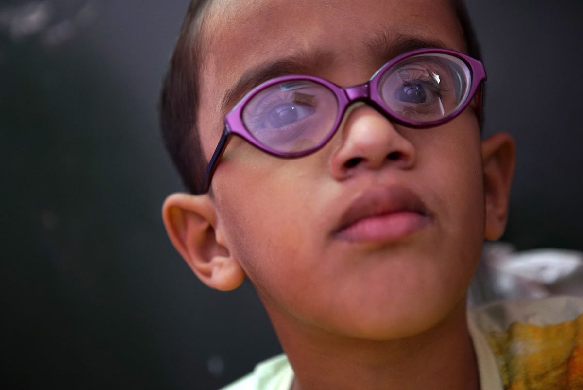Ismail from India had sight loss caused by retinopathy of prematurity