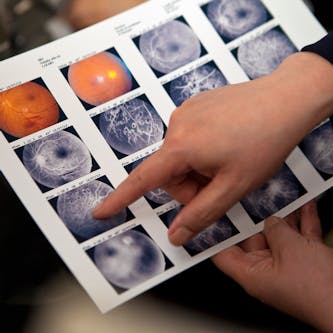 A finger points to an image on a set of scan results